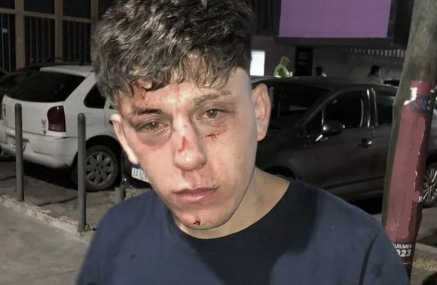 En este momento estás viendo Patovicas de un boliche de Quilmes golpearon salvajemente a un joven