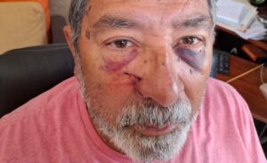Lee más sobre el artículo La Matanza: Volvía del médico y fue víctima de un brutal robo piraña