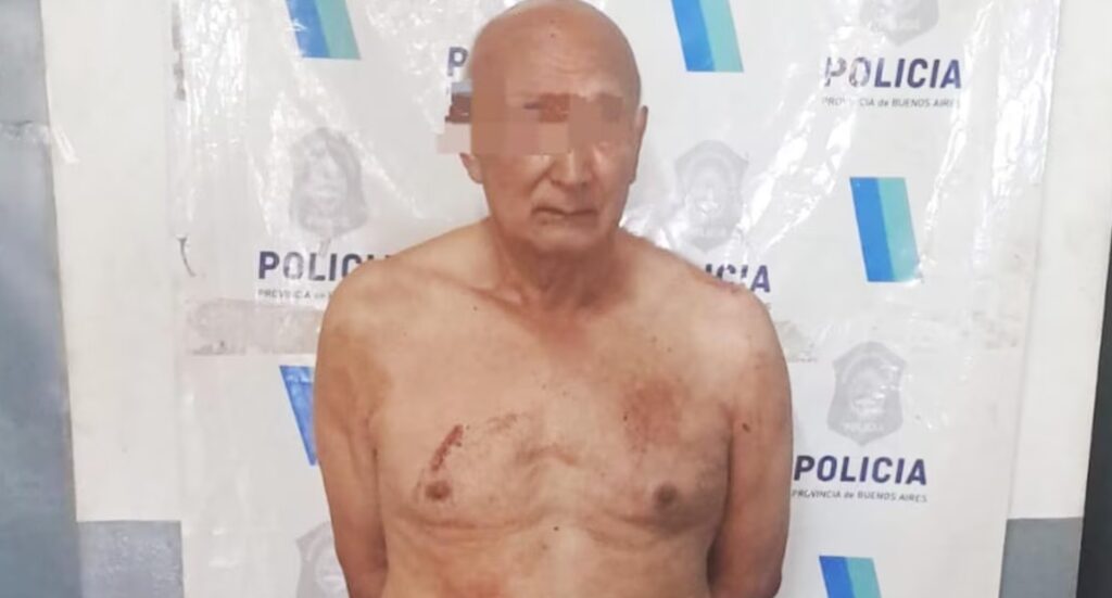 Lee más sobre el artículo Un jubilado mató a puñaladas a su mujer en Loma Hermosa: “Me tenía cansado”