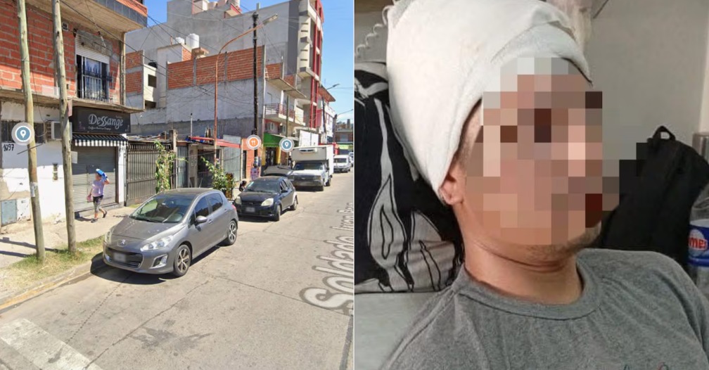 En este momento estás viendo La Matanza: Discutió en el colectivo y fue atacado a martillazos en la cabeza