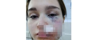 Lee más sobre el artículo Solano: denuncian que un hombre agredió a su pareja, lastimó a su hija y huyó