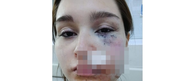 Lee más sobre el artículo Solano: denuncian que un hombre agredió a su pareja, lastimó a su hija y huyó