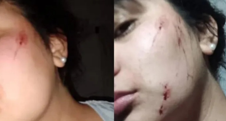 En este momento estás viendo «Me quiso cortar la cara con vidrios»: el testimonio de una joven agredida en Budge