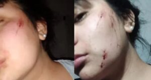 Lee más sobre el artículo Budge: una mujer denunció una agresión de su ex pareja y ahora está en la calle
